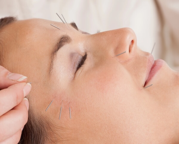 service_Facial_Acupuncture