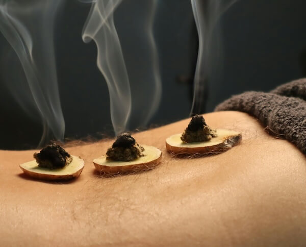 service_moxibustion